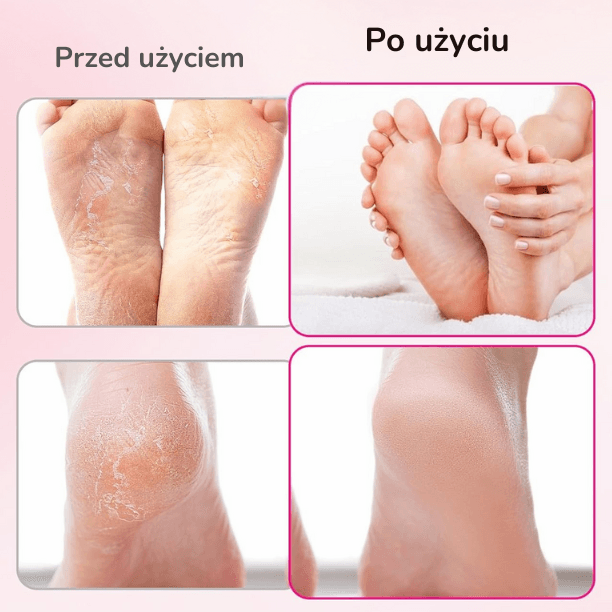 SoftFoot pilnik-elektryczny do stóp/paznokci 30-ściernych-krążków gratis ✨