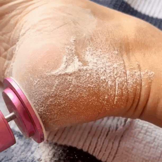 SoftFoot zestaw 60 krążków ściernych do stóp 🦶